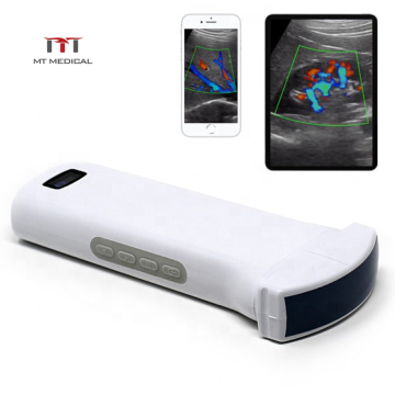 192 High element Color Doppler Wireless Ultrasound for doctor